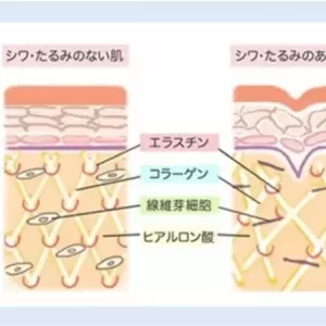 大阪 心斎橋で人気の美容鍼灸 HARIS【肌の構造について】のサムネイル